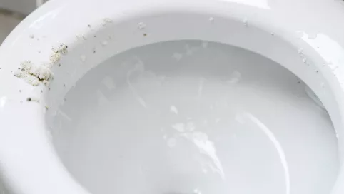 czym usunąć kamień z toalety